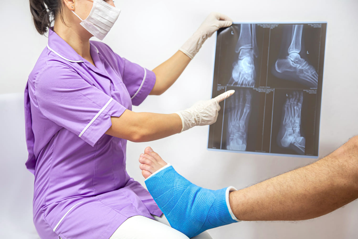 Reducción de fracturas y luxaciones en CDMX con especialistas en Ortopedia y Traumatología